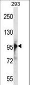 RNA Binding Motif Protein 10 antibody, LS-C162485, Lifespan Biosciences, Western Blot image 
