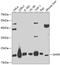 Dihydrofolate Reductase antibody, A1607, ABclonal Technology, Western Blot image 