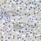 Catenin Beta 1 antibody, A2064, ABclonal Technology, Immunohistochemistry paraffin image 