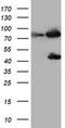 Coagulation Factor XIII A Chain antibody, TA800384, Origene, Western Blot image 