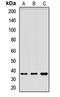 Mouse CD301 antibody, orb411888, Biorbyt, Western Blot image 