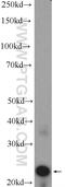 Crystallin Beta A2 antibody, 15750-1-AP, Proteintech Group, Western Blot image 