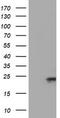 Ubiquitin Conjugating Enzyme E2 E3 antibody, TA504684, Origene, Western Blot image 