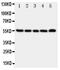 Tachykinin Receptor 1 antibody, PA1684, Boster Biological Technology, Western Blot image 