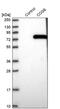 Conserved oligomeric Golgi complex subunit 6 antibody, PA5-59180, Invitrogen Antibodies, Western Blot image 