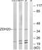 Zinc Finger DHHC-Type Containing 20 antibody, PA5-39359, Invitrogen Antibodies, Western Blot image 