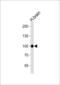 Cadherin 13 antibody, 57-664, ProSci, Western Blot image 