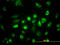 Acetyl-CoA Acyltransferase 2 antibody, LS-B6206, Lifespan Biosciences, Immunofluorescence image 