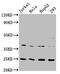 Hepcidin Antimicrobial Peptide antibody, CSB-RA010124A0HU, Cusabio, Western Blot image 