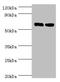 Ro60, Y RNA Binding Protein antibody, orb239099, Biorbyt, Western Blot image 