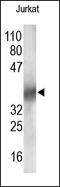 Pro-Apoptotic WT1 Regulator antibody, 251943, Abbiotec, Western Blot image 
