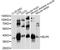 Elongator Acetyltransferase Complex Subunit 5 antibody, LS-C749843, Lifespan Biosciences, Western Blot image 