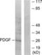 Platelet Derived Growth Factor Subunit B antibody, LS-C118554, Lifespan Biosciences, Western Blot image 