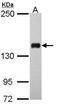 FA Complementation Group D2 antibody, GTX116037, GeneTex, Western Blot image 