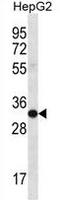 Sulfotransferase Family 1C Member 3 antibody, AP54104PU-N, Origene, Western Blot image 