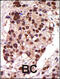 Protein Kinase D3 antibody, 62-599, ProSci, Immunofluorescence image 