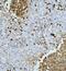 Penta-EF-Hand Domain Containing 1 antibody, A09591-2, Boster Biological Technology, Immunohistochemistry paraffin image 