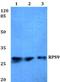 Ribosomal Protein S9 antibody, A05633, Boster Biological Technology, Western Blot image 