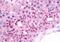 Neuromedin B Receptor antibody, MBS242772, MyBioSource, Immunohistochemistry paraffin image 