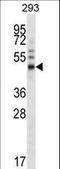 Forkhead Box A1 antibody, LS-C166211, Lifespan Biosciences, Western Blot image 