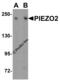 Piezo Type Mechanosensitive Ion Channel Component 2 antibody, 8613, ProSci, Western Blot image 