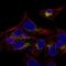 Arylsulfatase E antibody, HPA060518, Atlas Antibodies, Immunofluorescence image 