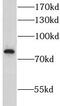 Leucine Rich Repeat And Sterile Alpha Motif Containing 1 antibody, FNab04866, FineTest, Western Blot image 