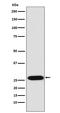 Protein lin-28 homolog A antibody, M01966-1, Boster Biological Technology, Western Blot image 