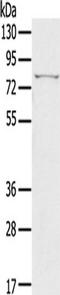 Inhibitor Of Nuclear Factor Kappa B Kinase Subunit Epsilon antibody, TA350082, Origene, Western Blot image 