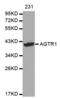 Angiotensin II type-1 receptor antibody, STJ22549, St John