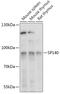 SP140 Nuclear Body Protein antibody, 18-016, ProSci, Western Blot image 
