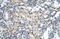 U1 small nuclear ribonucleoprotein 70 kDa antibody, ARP40275_P050, Aviva Systems Biology, Immunohistochemistry paraffin image 