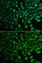 Inositol Monophosphatase 1 antibody, GTX54348, GeneTex, Immunocytochemistry image 