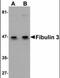EGF Containing Fibulin Extracellular Matrix Protein 1 antibody, orb89834, Biorbyt, Western Blot image 