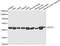 Acetyl-CoA Acetyltransferase 1 antibody, STJ27288, St John