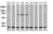 NADH:Ubiquinone Oxidoreductase Subunit B10 antibody, M11886-1, Boster Biological Technology, Western Blot image 