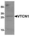 V-Set Domain Containing T Cell Activation Inhibitor 1 antibody, LS-C201033, Lifespan Biosciences, Western Blot image 