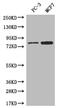 Leucine-rich repeat neuronal protein 3 antibody, CSB-PA880968LA01HU, Cusabio, Western Blot image 