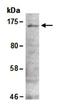 Zinc Finger And BTB Domain Containing 38 antibody, orb66926, Biorbyt, Western Blot image 