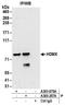 MDM4 Regulator Of P53 antibody, A303-870A, Bethyl Labs, Immunoprecipitation image 