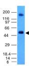 Carbonic Anhydrase 9 antibody, GTX34452, GeneTex, Western Blot image 