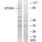 Stonin-1 antibody, PA5-49902, Invitrogen Antibodies, Western Blot image 