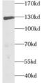 hTIE2 antibody, FNab08690, FineTest, Western Blot image 