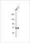 Clamp antibody, 58-038, ProSci, Western Blot image 