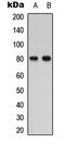 Parathyroid Hormone 1 Receptor antibody, abx121678, Abbexa, Western Blot image 
