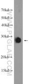 Lin-7 Homolog A, Crumbs Cell Polarity Complex Component antibody, 25150-1-AP, Proteintech Group, Western Blot image 
