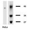 KRT18 antibody, SM3044B, Origene, Western Blot image 