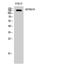 SR-Related CTD Associated Factor 4 antibody, A10224-1, Boster Biological Technology, Western Blot image 