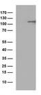 Endoplasmic Reticulum Aminopeptidase 1 antibody, CF812889, Origene, Western Blot image 