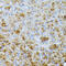 Chymotrypsinogen B1 antibody, 15-844, ProSci, Immunohistochemistry paraffin image 